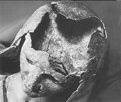 The head is a face-mask plus a veil. Notice the two tongue-like projections curving toward the nape and united by the main panel of the mantle