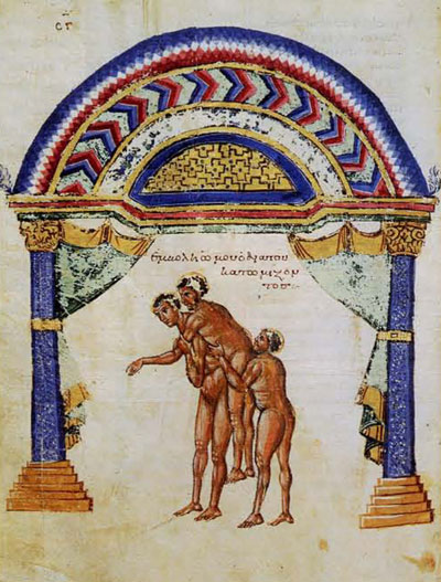 Resetting a Dsilocated Shoulder with the help of assistants. One assistant forces his shoulder into the patient's armpit while the other helper holds the patient aloft.Biblioteca Medica Medicea laurenziana, Florence, Codex Laurentianus 74.7: c. 185v