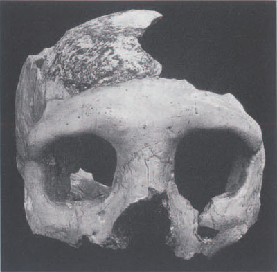 The Krapina Neandertal specimen called the "C" skull (also referred to as Krapina 3). This is the most complete of the skull fragments found at Krapina. The nature fo the extensive bone breakage pattern on all of the skeletal elements has led many researchers to propose that the Krapina peoples were cannibalized. This view is no longer totally accepted since there are other explanations of these types of breaks on bones. Croatian Natural History Museum 