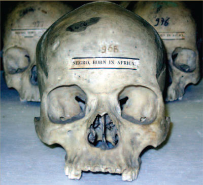 A human skull with a label glued to the forehead.