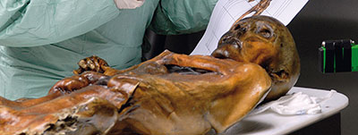 Ötzi's remains in a lab.