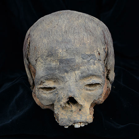 Front view of a human skull.
