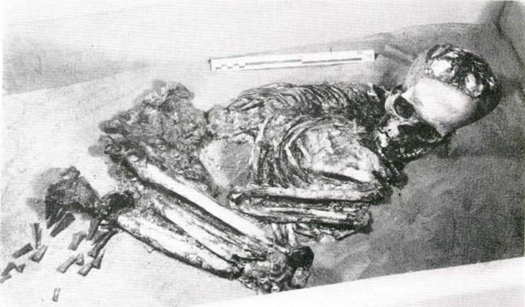 A skeleton in fetal position.