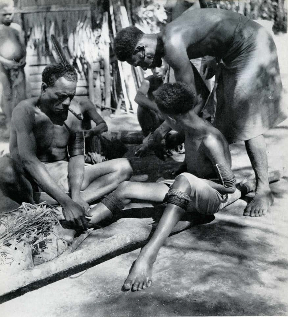A youth sitting on the ground, two men dressing him.